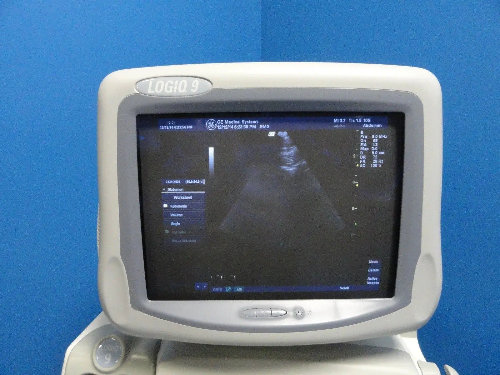 GE 10S Sector Ultrasound Transducer for GE Logiq 7, 9, S6 & Vivid Series (8390) DIAGNOSTIC ULTRASOUND MACHINES FOR SALE