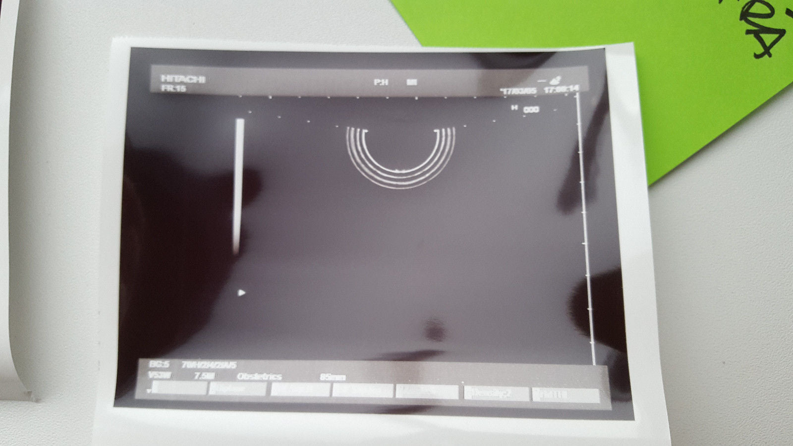 Hitachi EUP-V53W GYN ultrasound transducer DIAGNOSTIC ULTRASOUND MACHINES FOR SALE