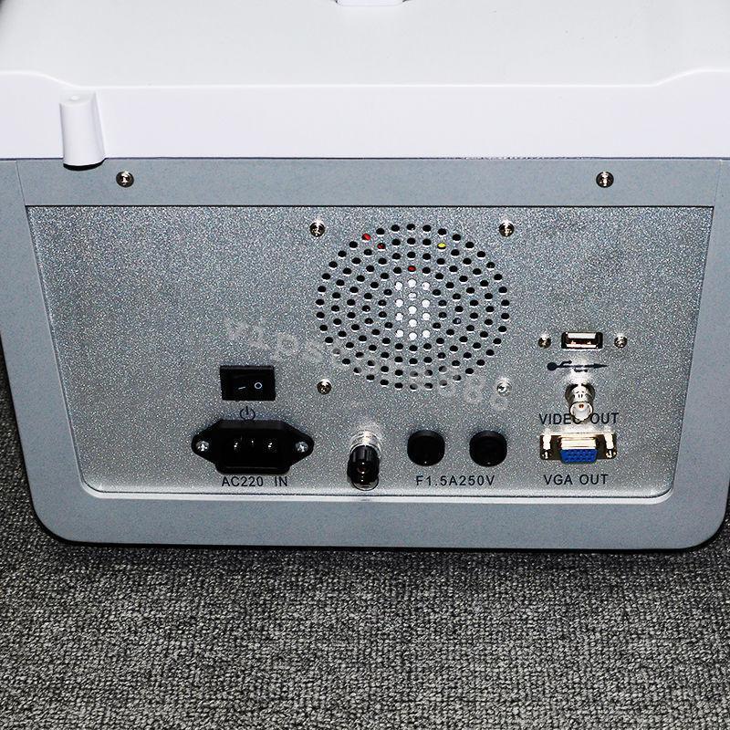 Digital Portable Ultrasound Scanner Machine + Convex & Transvaginal 2 Probes DHL 190891270993 DIAGNOSTIC ULTRASOUND MACHINES FOR SALE