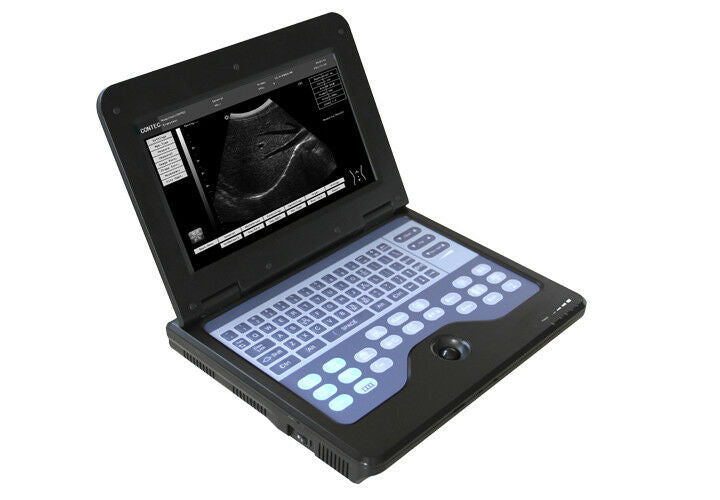 Human Abdomen Ultrasound Machine Laptop Ultrasound Scanner +Convex Probe,CE &USA DIAGNOSTIC ULTRASOUND MACHINES FOR SALE