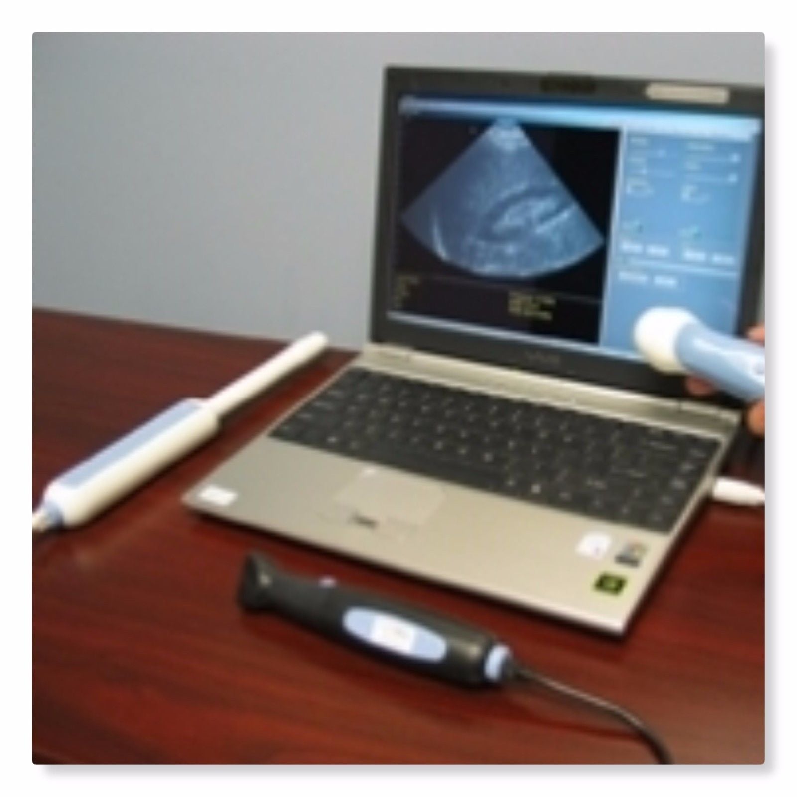 GENUINE USB ULTRASOUND PROBE: EC 7.5 MHz Transvaginal probe - 99-5931 DIAGNOSTIC ULTRASOUND MACHINES FOR SALE