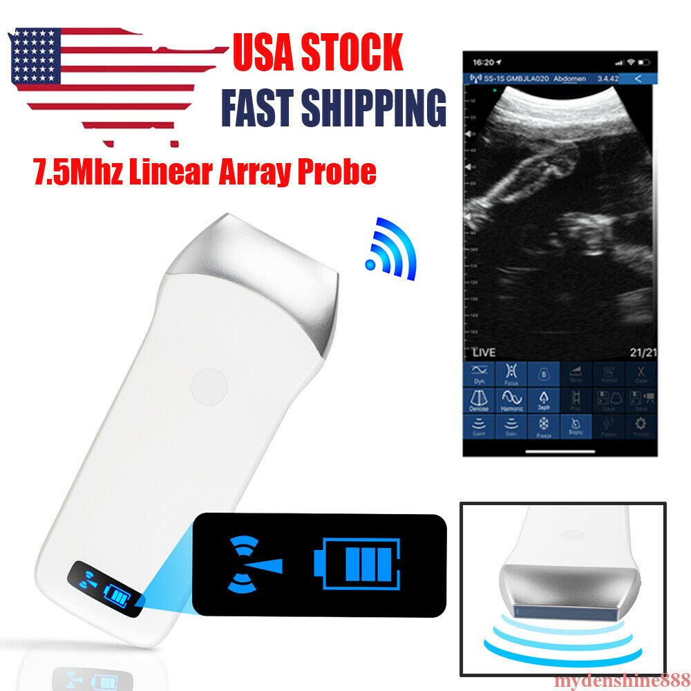 Portable WIFI Wireless Ultrasound Scanner Machine System Linear Probe 7.5Mhz DIAGNOSTIC ULTRASOUND MACHINES FOR SALE