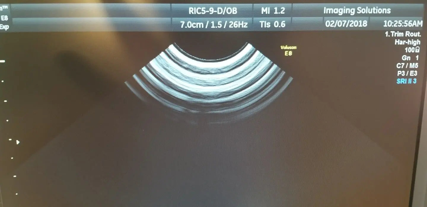 GE RIC5-9-D Ultrasound Transducer / Probe DIAGNOSTIC ULTRASOUND MACHINES FOR SALE