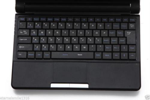 Laptop Ultrasound machine Scanner system 7.5Mhz High Frequecy Linear Probe+3D A+ DIAGNOSTIC ULTRASOUND MACHINES FOR SALE