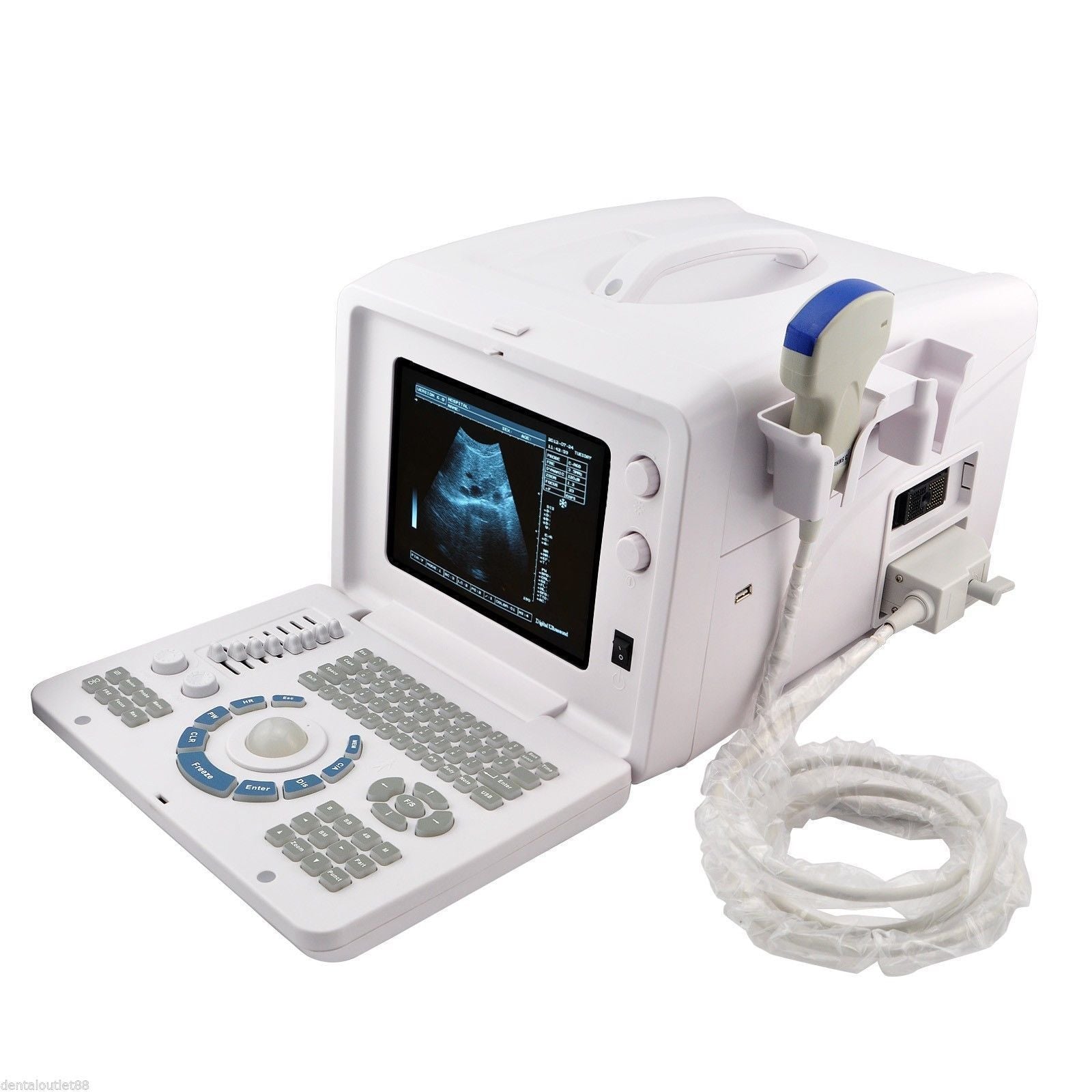SALE 20% OFF!Ultrasound Machine Ultrasound Scanner with transvaginal probe +3D 190891893895 DIAGNOSTIC ULTRASOUND MACHINES FOR SALE