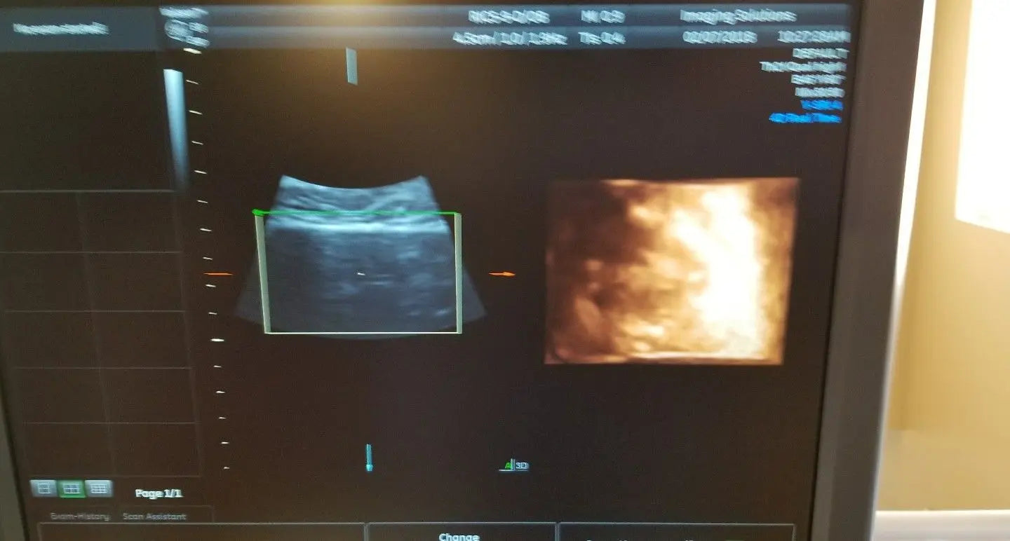 GE RIC5-9-D Ultrasound Transducer / Probe DIAGNOSTIC ULTRASOUND MACHINES FOR SALE