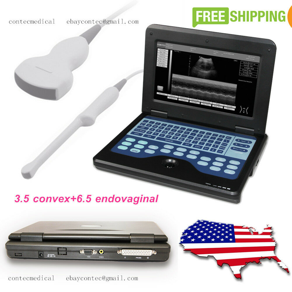 Portable Laptop Digital Ultrasound Scanner 3.5 Convex+ 6.5 Transvaginal 2 probes DIAGNOSTIC ULTRASOUND MACHINES FOR SALE