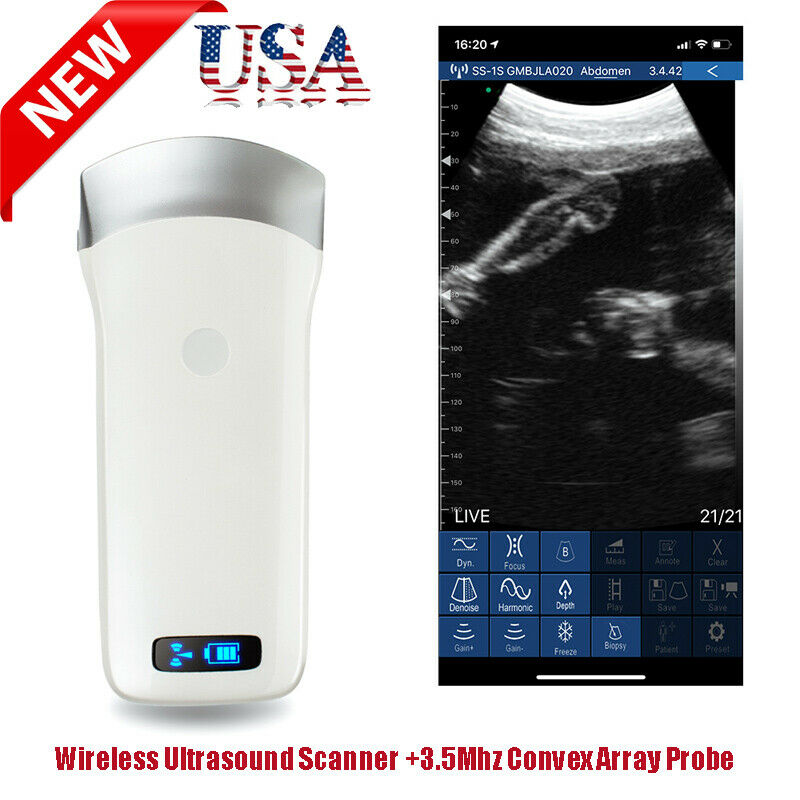 DigtalPortable WIFI Wireless Ultrasound Scanner Machine+3.5Mhz ConvexArray Probe DIAGNOSTIC ULTRASOUND MACHINES FOR SALE