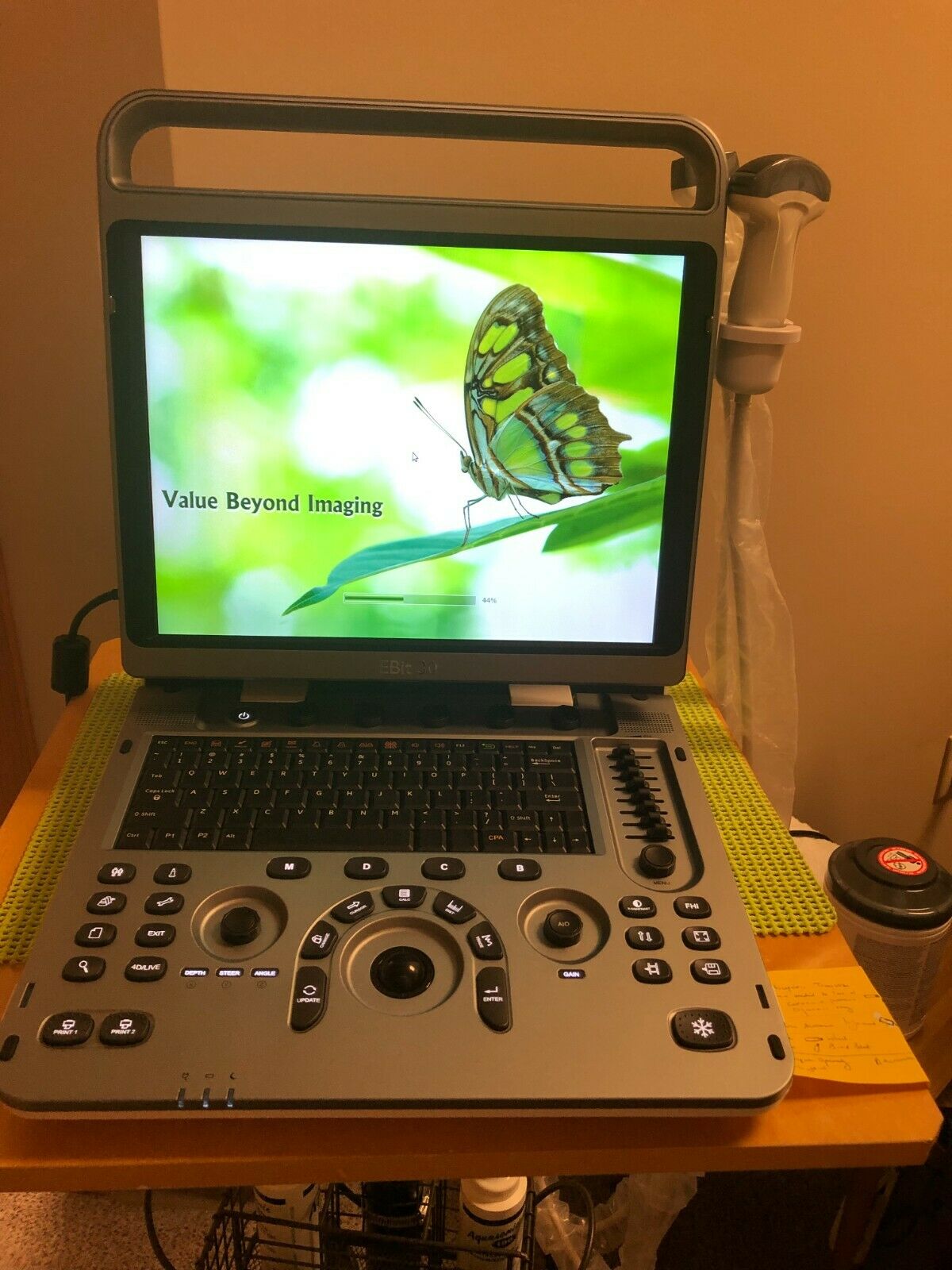 Chison Ebit 30 ultrasound with 2 probes less than 6 months old DIAGNOSTIC ULTRASOUND MACHINES FOR SALE