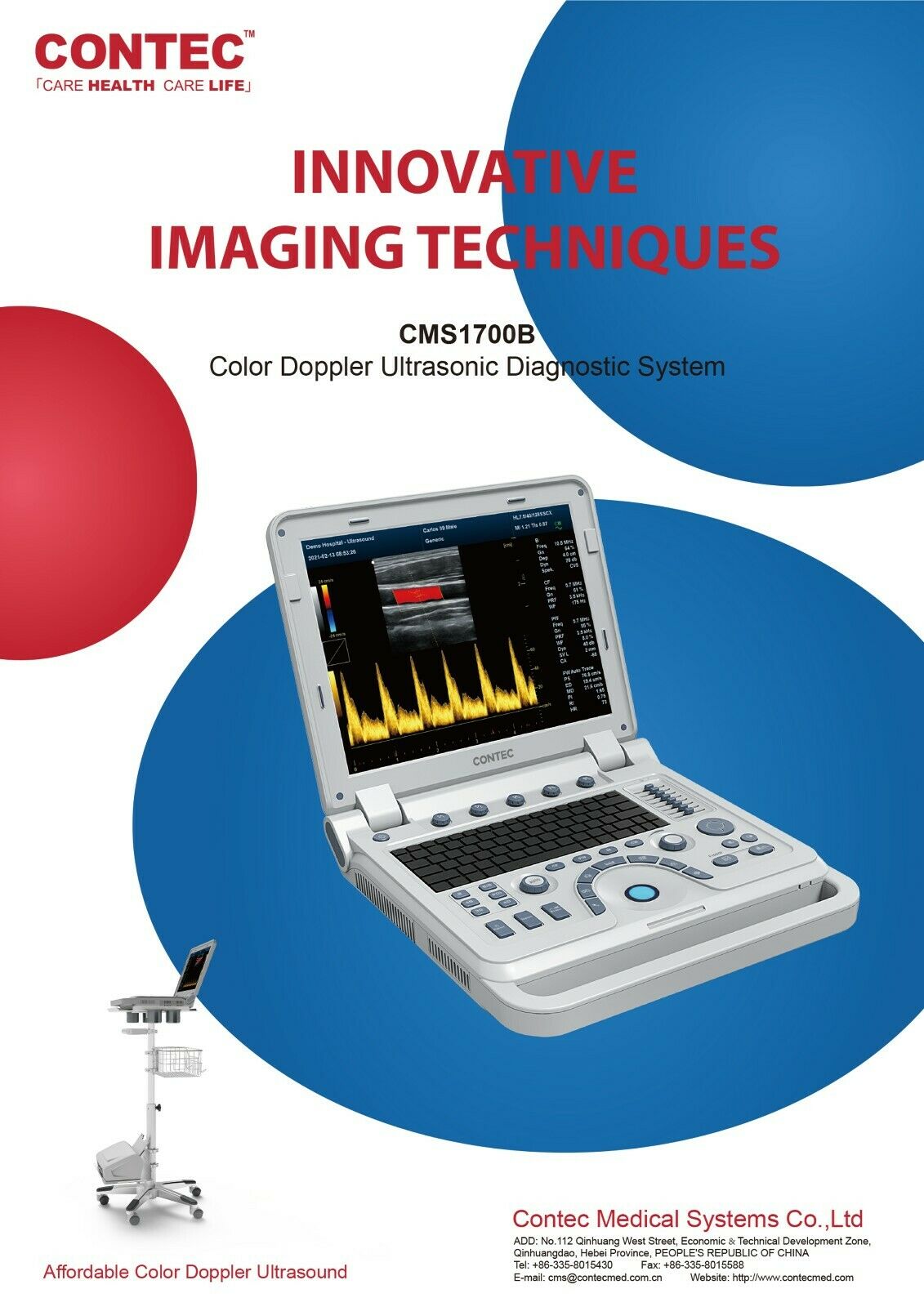 Color Doppler Ultrasound Scanner Cardiac Machine + Phased Array Probe Heart Exam DIAGNOSTIC ULTRASOUND MACHINES FOR SALE