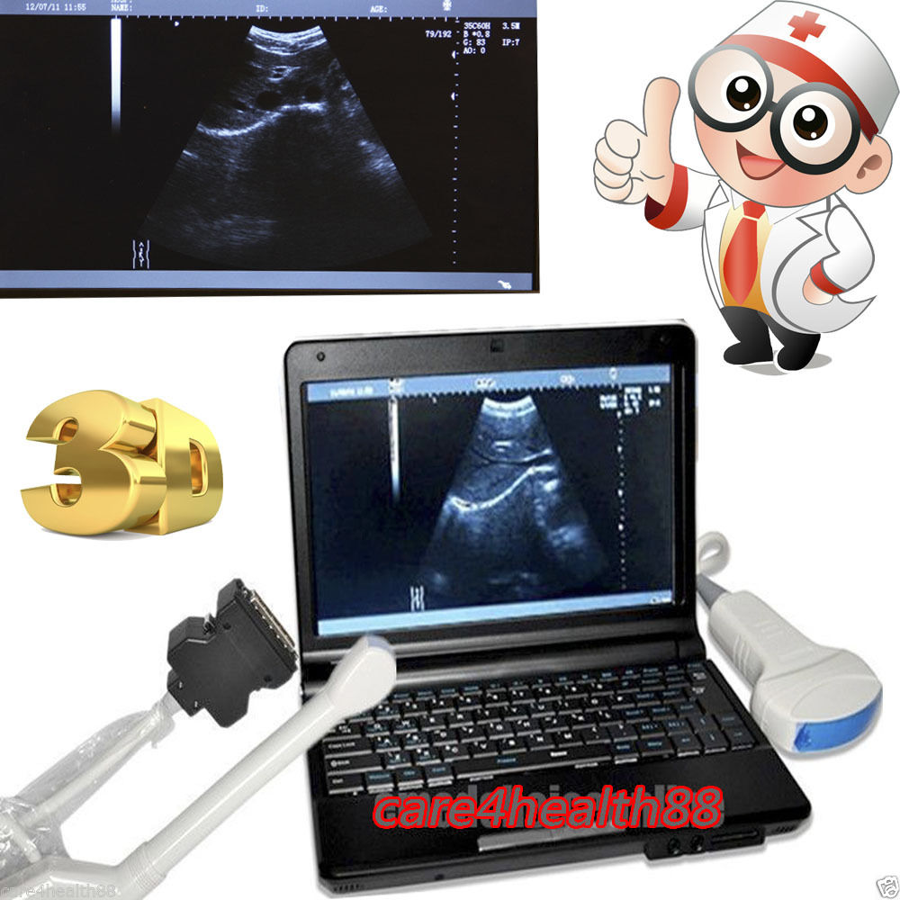 Laptop Digital Ultrasound Machine Scanner Convex +Transvaginal Probe + Extra 3D DIAGNOSTIC ULTRASOUND MACHINES FOR SALE