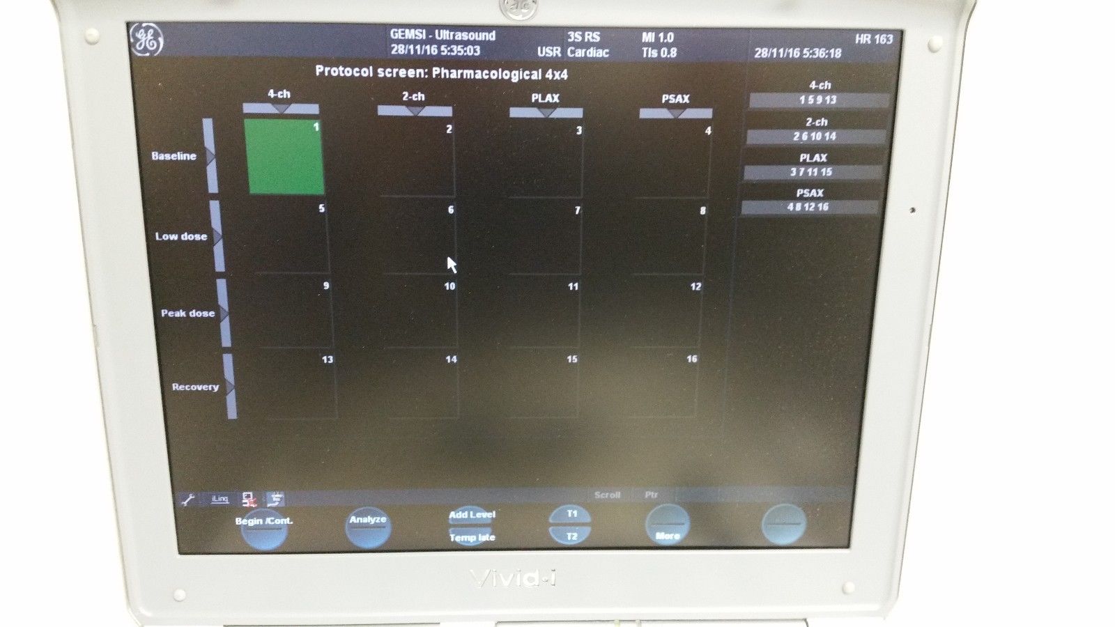 a computer monitor with a lot of buttons on it