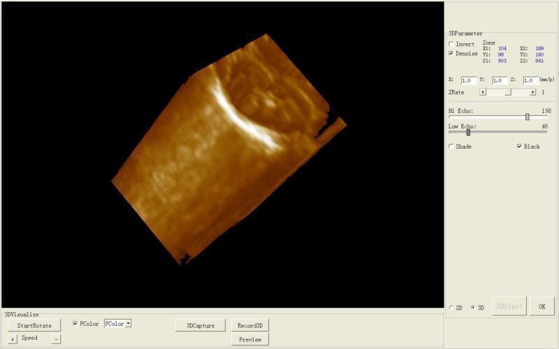 Full Digital Ultrasound Scanner Machine With Convex Transvaginal Probe +3D Image 190891911506 DIAGNOSTIC ULTRASOUND MACHINES FOR SALE