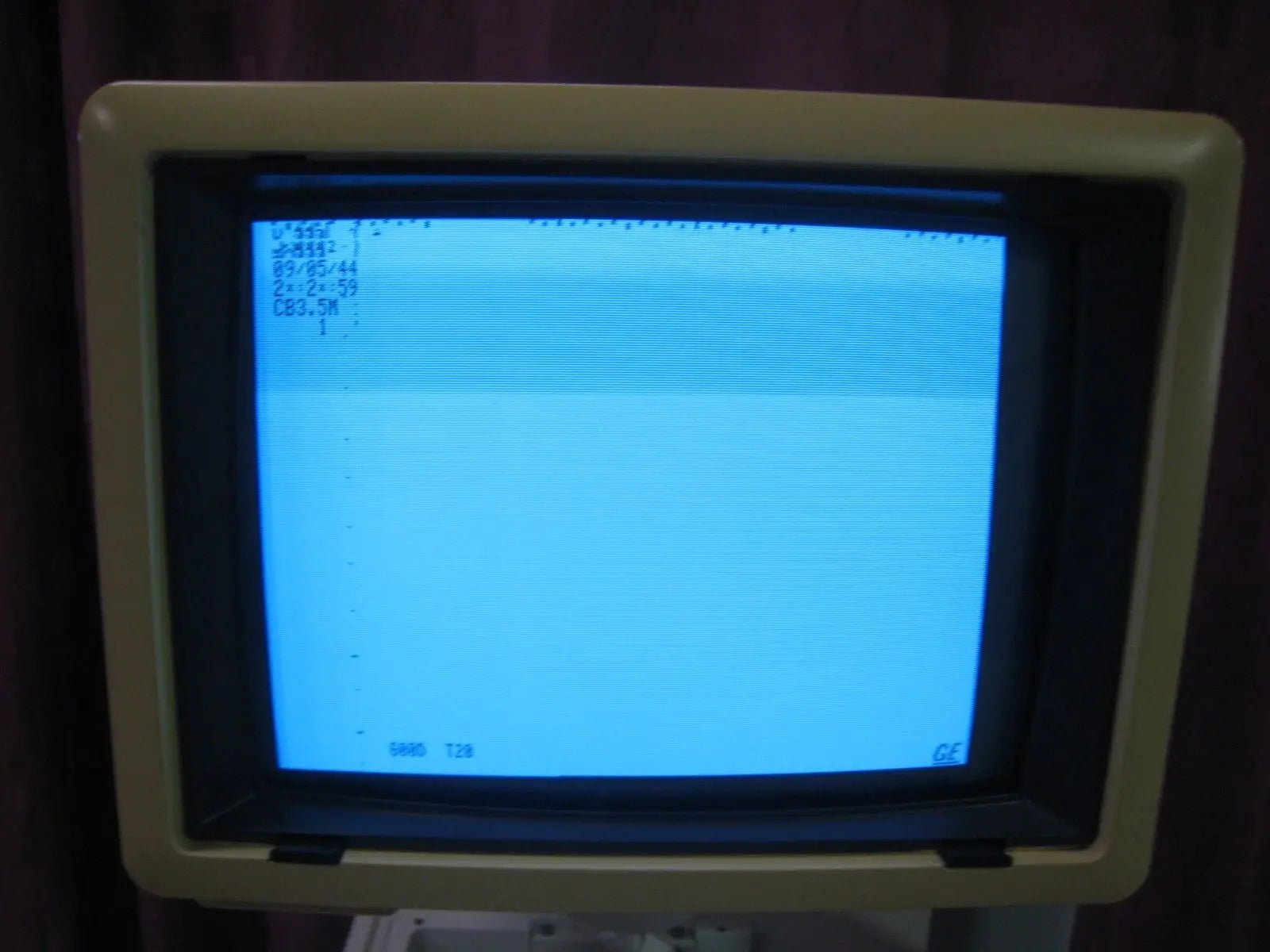 GE RT3200 Advantage II Ultrasound DIAGNOSTIC ULTRASOUND MACHINES FOR SALE