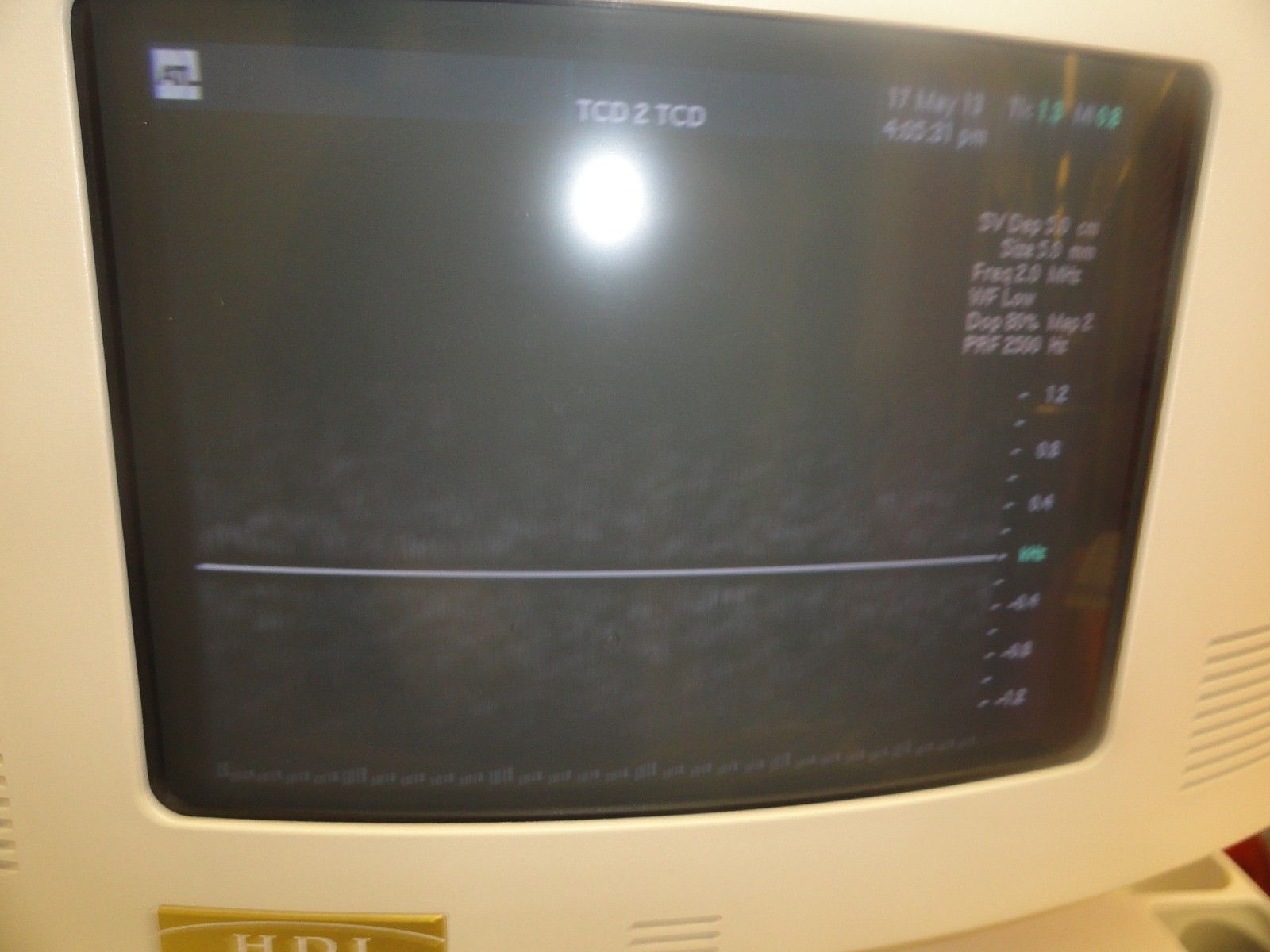 ATL D2TC Static HDI 2.0MHz P/N 4000-0310-02 PW Doppler Transcranial Probe ~5554 DIAGNOSTIC ULTRASOUND MACHINES FOR SALE