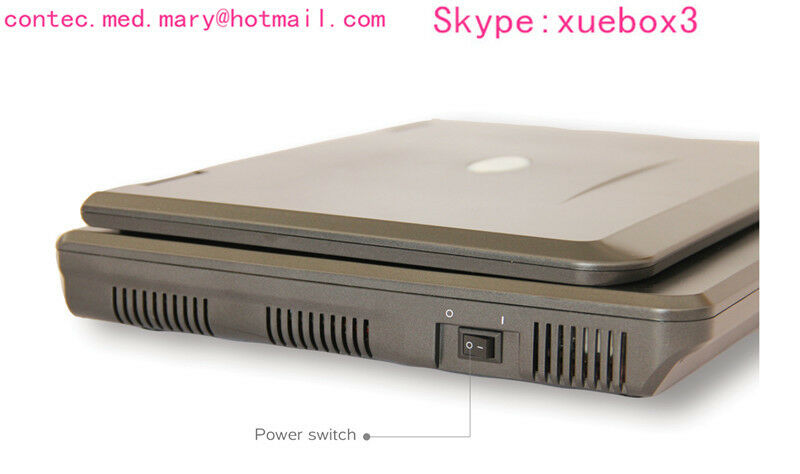 New CE Portable USB Digital Ultrasound machine Scanner +3.5 Mhz CONVEX Probe,USA 658126883672 DIAGNOSTIC ULTRASOUND MACHINES FOR SALE