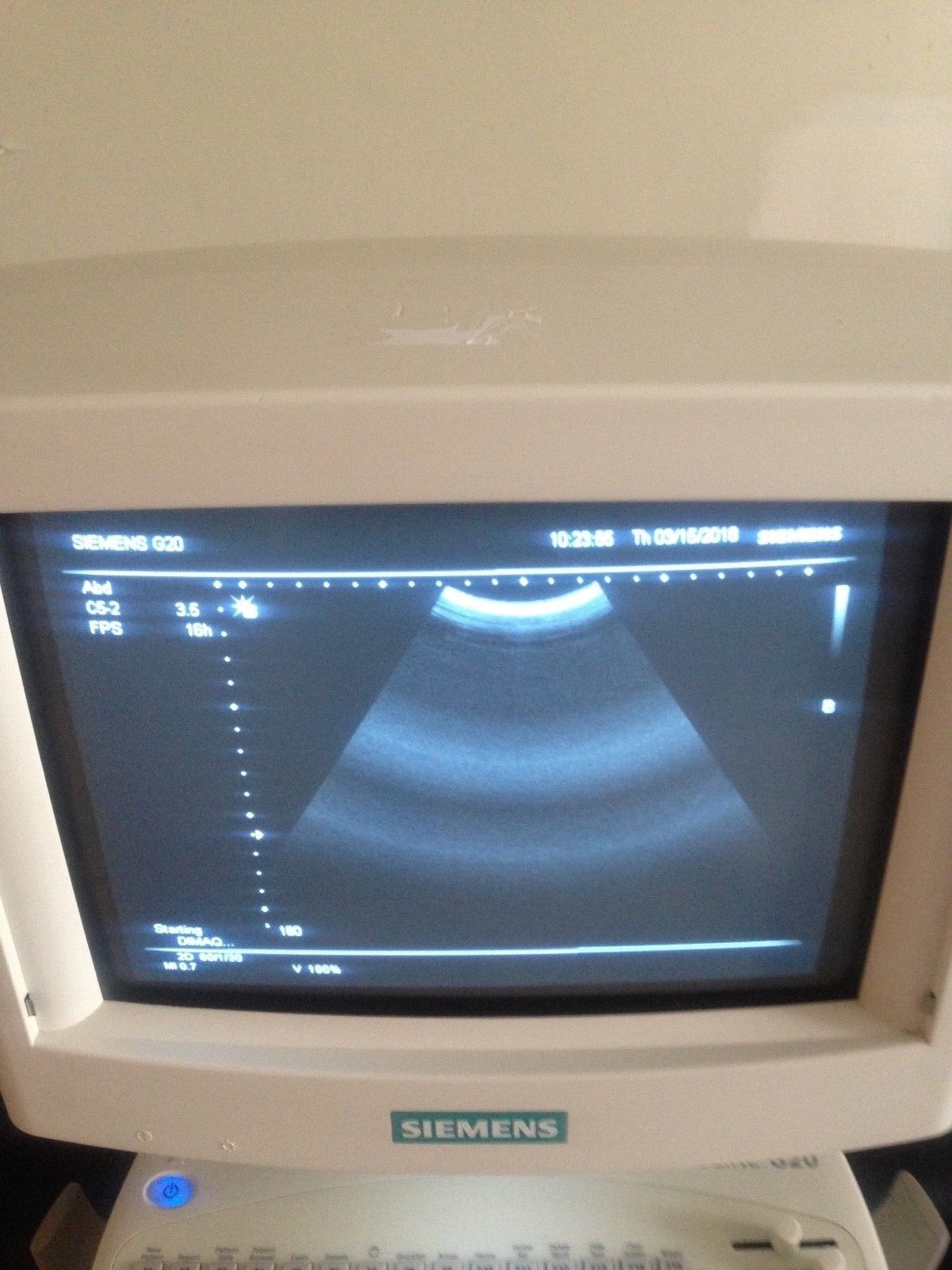 Siemens Sonoline G20 Ultrasound C5-2 Probe & Printer OB-GYN, Urology DIAGNOSTIC ULTRASOUND MACHINES FOR SALE