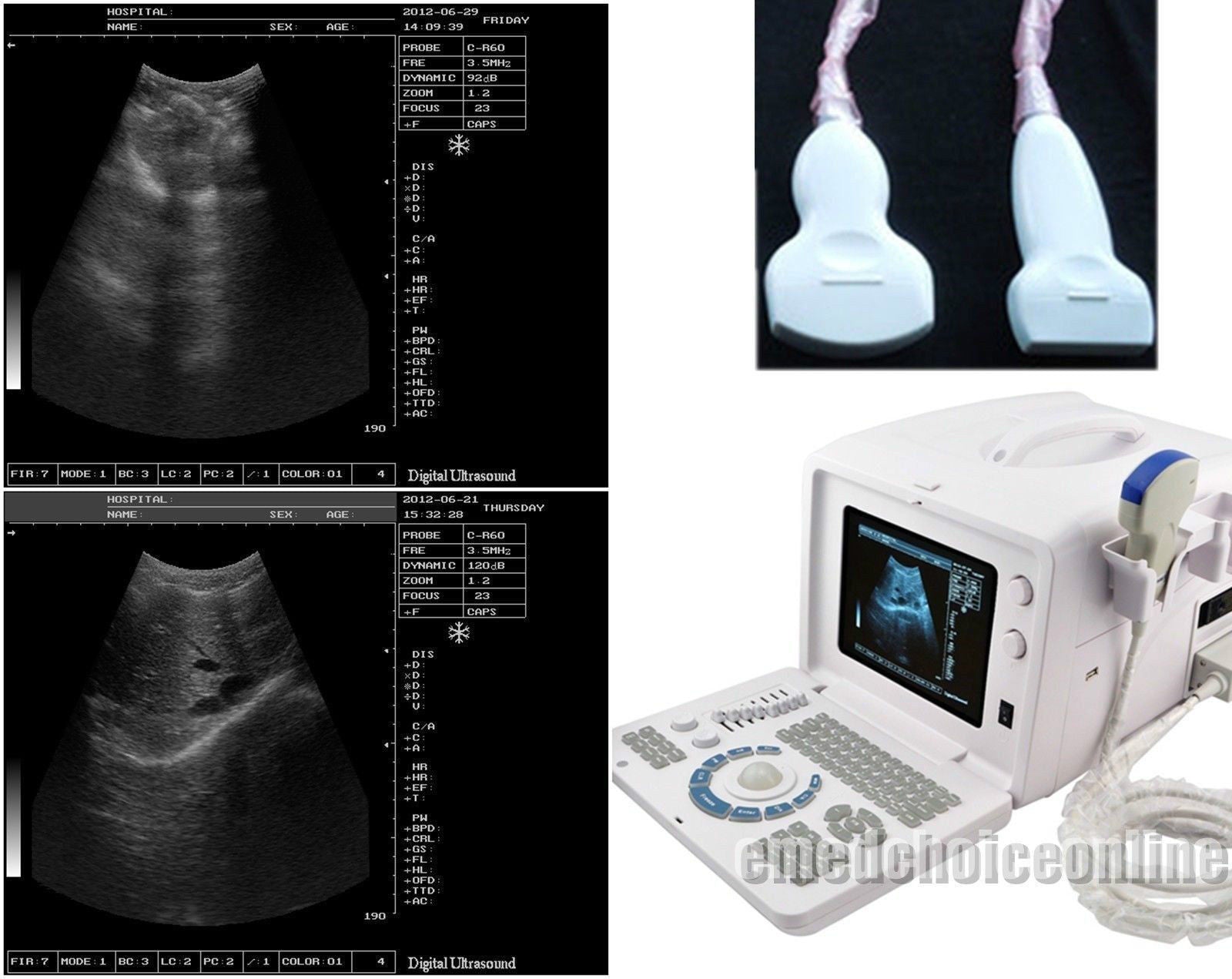New Digital Ultrasound machine Scanner System Convex + linear Probe +3D Set pack 190891758668 DIAGNOSTIC ULTRASOUND MACHINES FOR SALE