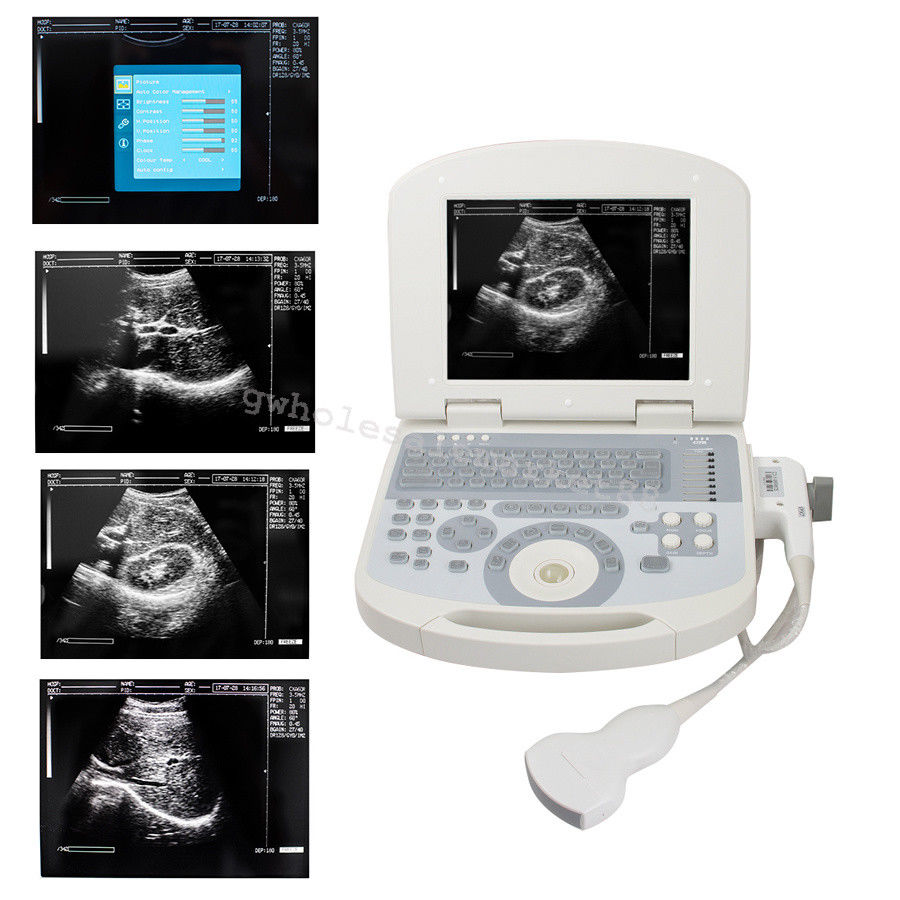 Portable Ultrasound Machine Scanner System Convex probe 3D Software Best Image 190891045898 DIAGNOSTIC ULTRASOUND MACHINES FOR SALE