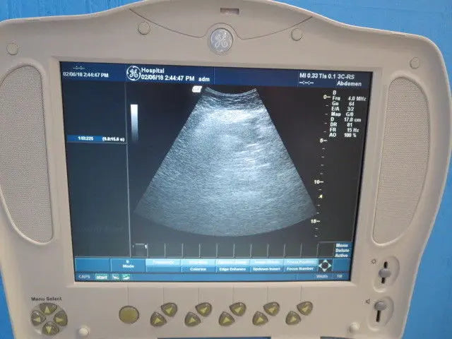 GE Logiq Book XP 3C-RS Ultrasound Probe Transducer 2333880 DIAGNOSTIC ULTRASOUND MACHINES FOR SALE