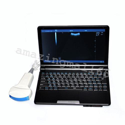 Digital Laptop Machine Ultrasound Scanner + 7.5 Linear Probe/Transducer +3D CE 190891468864 DIAGNOSTIC ULTRASOUND MACHINES FOR SALE
