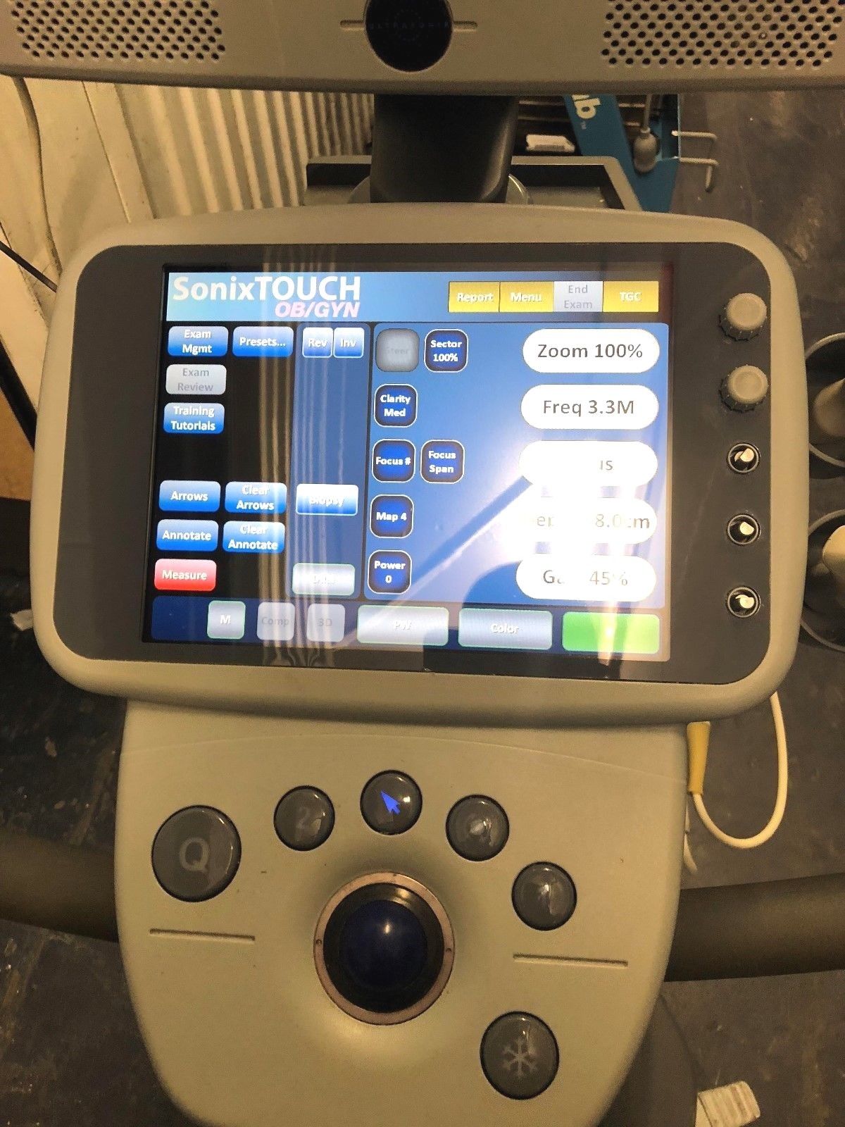 ULTRASONIX SONIXTOUCH OB / GYN - VASCULAR ULTRASOUND SYSTEM DIAGNOSTIC ULTRASOUND MACHINES FOR SALE