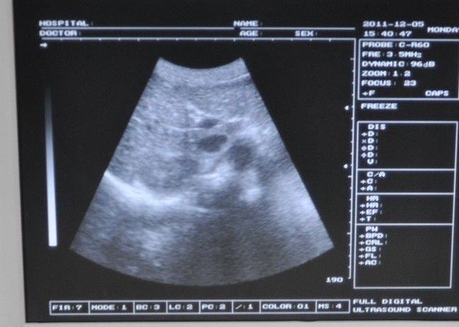 Professional Portable Ultrasound Scanner System Convex +Transvaginal Probe + 3D DIAGNOSTIC ULTRASOUND MACHINES FOR SALE