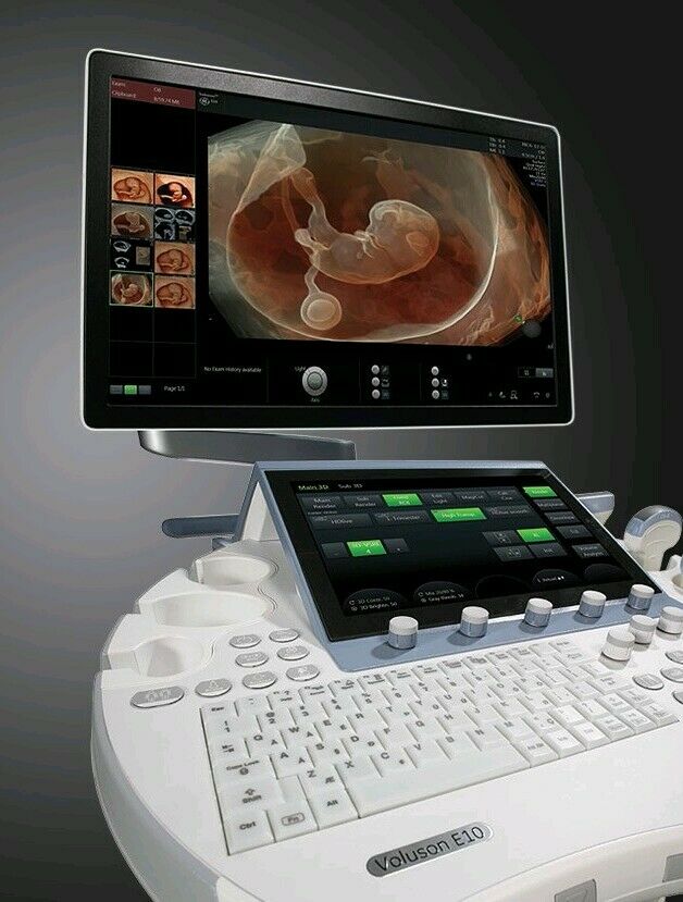 GE Refurbished - GE Voluson E10 BT16 Ultrasound System - Silhouette Imaging DIAGNOSTIC ULTRASOUND MACHINES FOR SALE