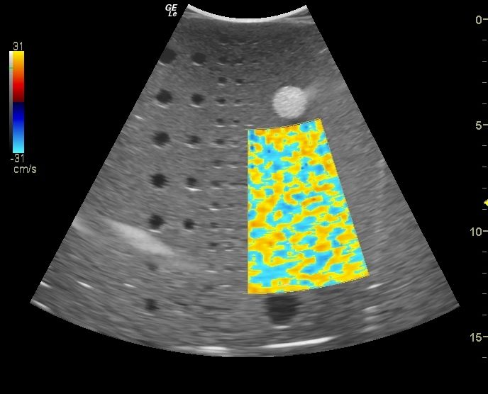 GE Logiq E Ultrasound System DIAGNOSTIC ULTRASOUND MACHINES FOR SALE