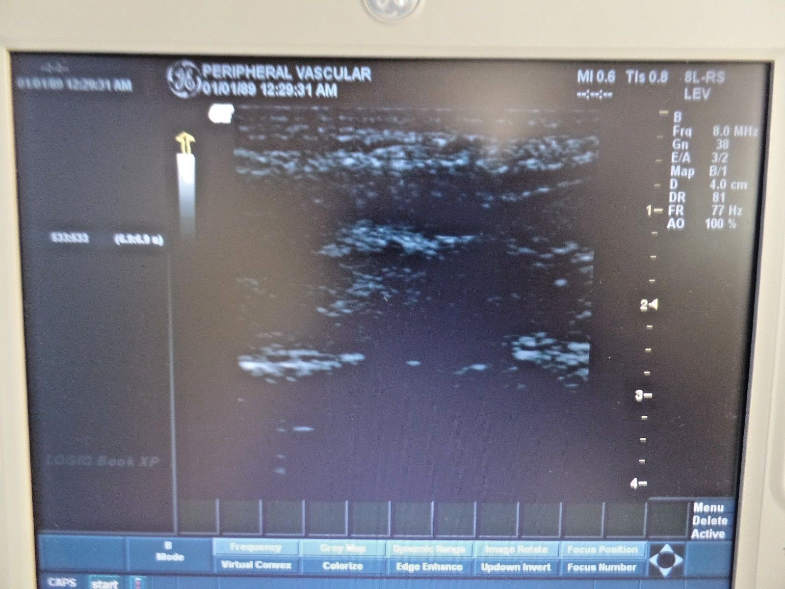 GE Logiq Book XP Ultrasound SV 2.0 with 8L-RS Probe DOM 2005 DIAGNOSTIC ULTRASOUND MACHINES FOR SALE