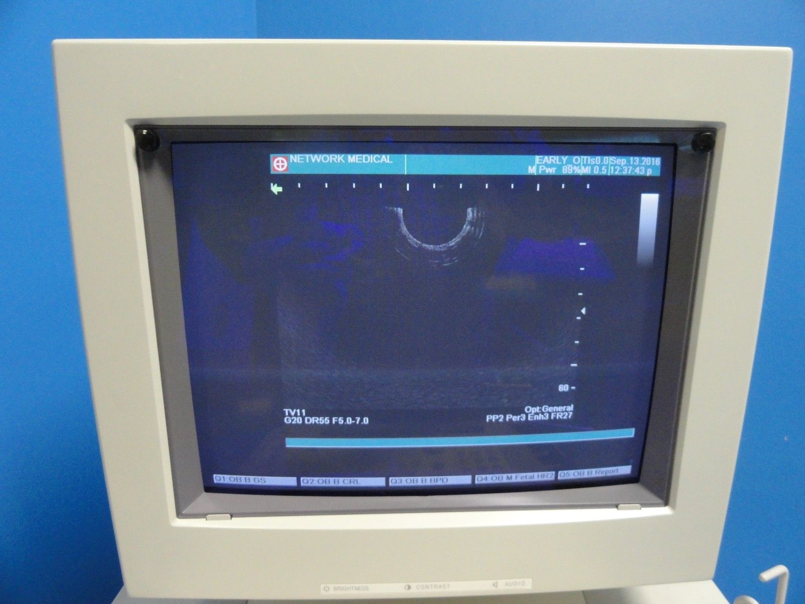 SHIMADZU TV11R-055U Transvaginal Probe For SDU-350/450 SDU-1100/1200/2200(10971) DIAGNOSTIC ULTRASOUND MACHINES FOR SALE