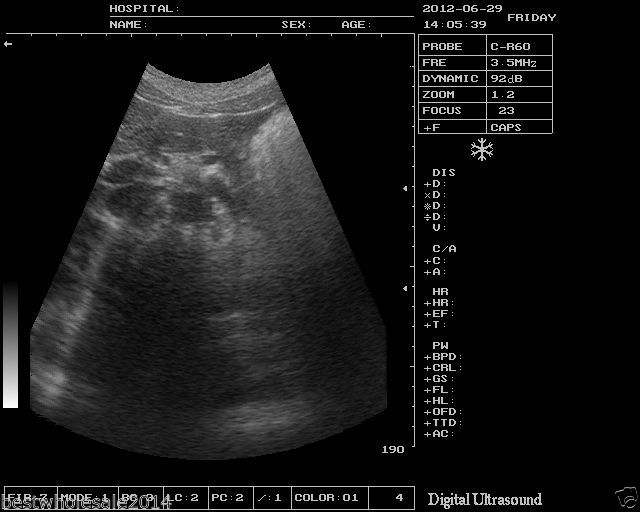 veterinarian B Ultrasound Scanner Machine Micro-convex Array Probe Animals 3D 190891743565 DIAGNOSTIC ULTRASOUND MACHINES FOR SALE