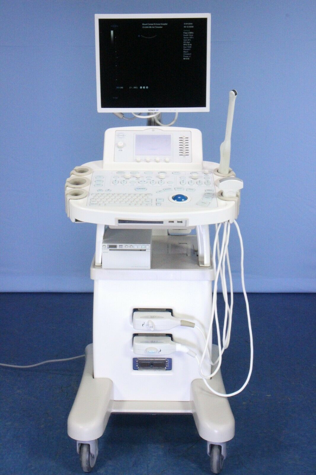Ultrasonix Sonix OP Ultrasound with Two Probes, Printer, & Warranty!! Tested!! DIAGNOSTIC ULTRASOUND MACHINES FOR SALE