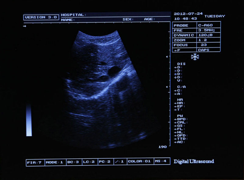 Top selling Medical Ultrasound Scanner System + linear Probe + 3D system DIAGNOSTIC ULTRASOUND MACHINES FOR SALE