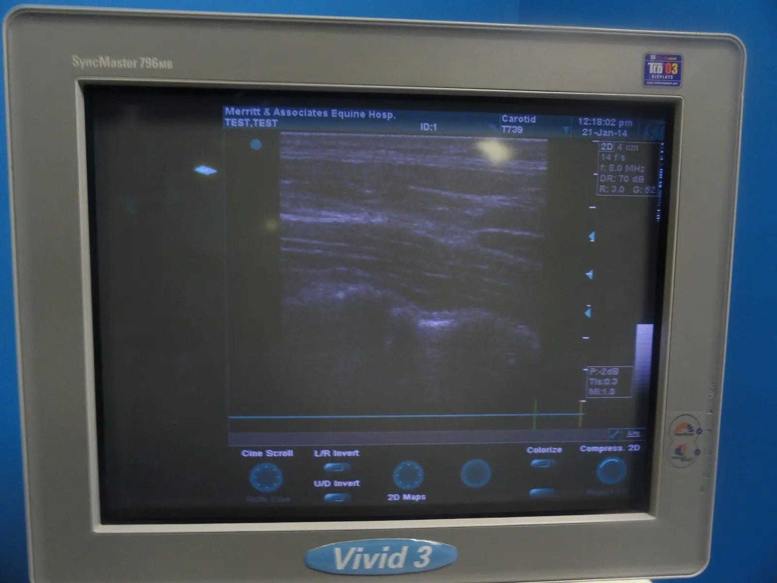 GE T739 P/N 2128151-2 6.7/D5.0 MHz Linear Array Ultrasound Transducer (6246) DIAGNOSTIC ULTRASOUND MACHINES FOR SALE