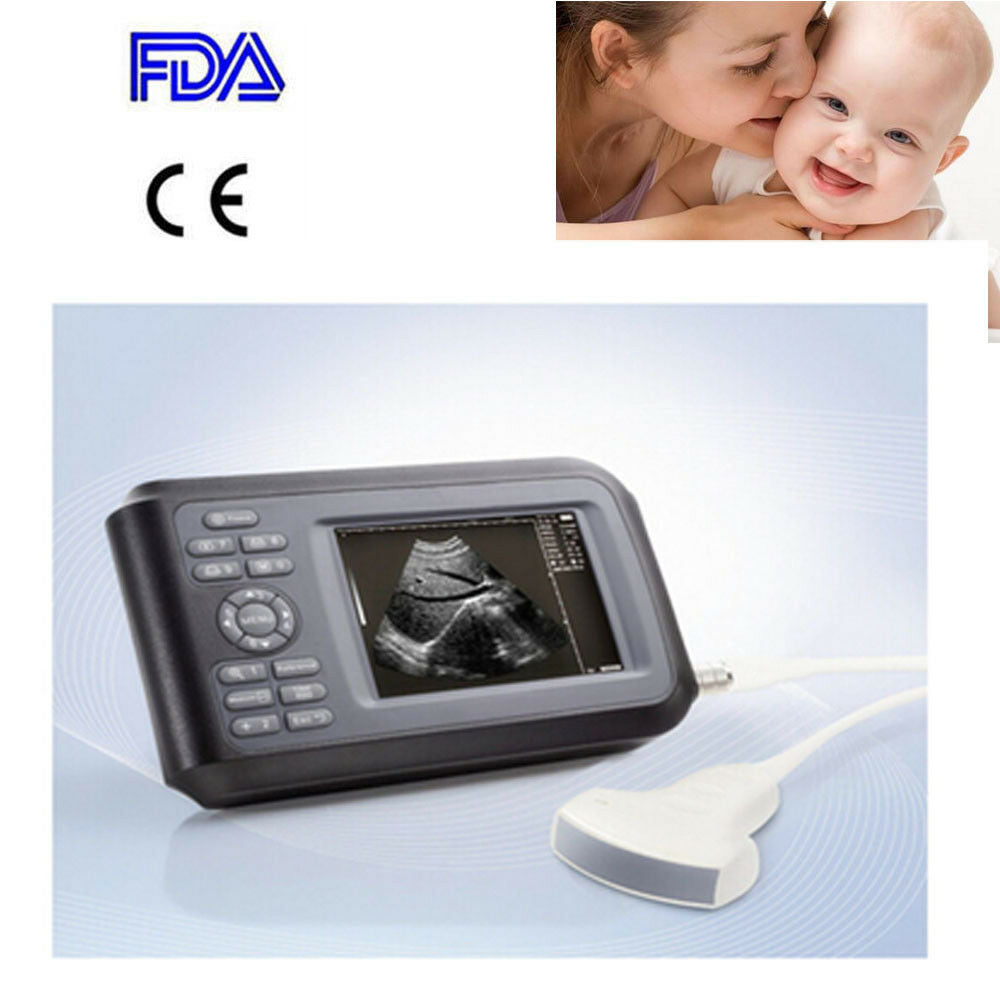 Portable Ultrasound Machine Scanner Ultrasound Device Convex Human Pregnancy A+ DIAGNOSTIC ULTRASOUND MACHINES FOR SALE
