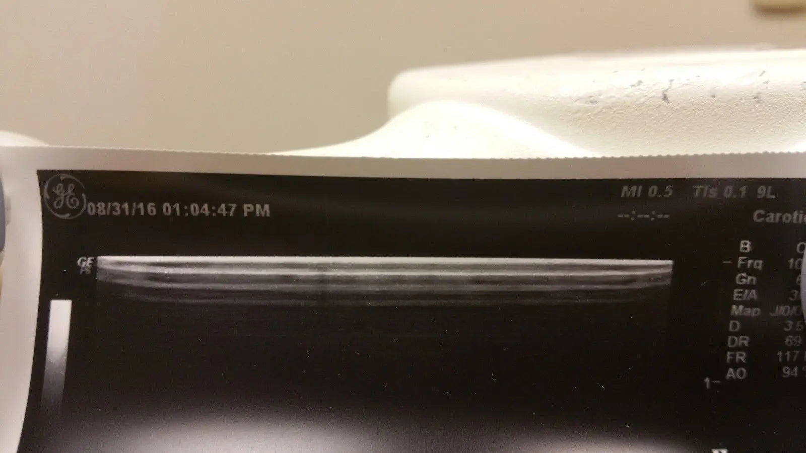 GE Ml6-15-D Transducer Ultrasound Probe DIAGNOSTIC ULTRASOUND MACHINES FOR SALE