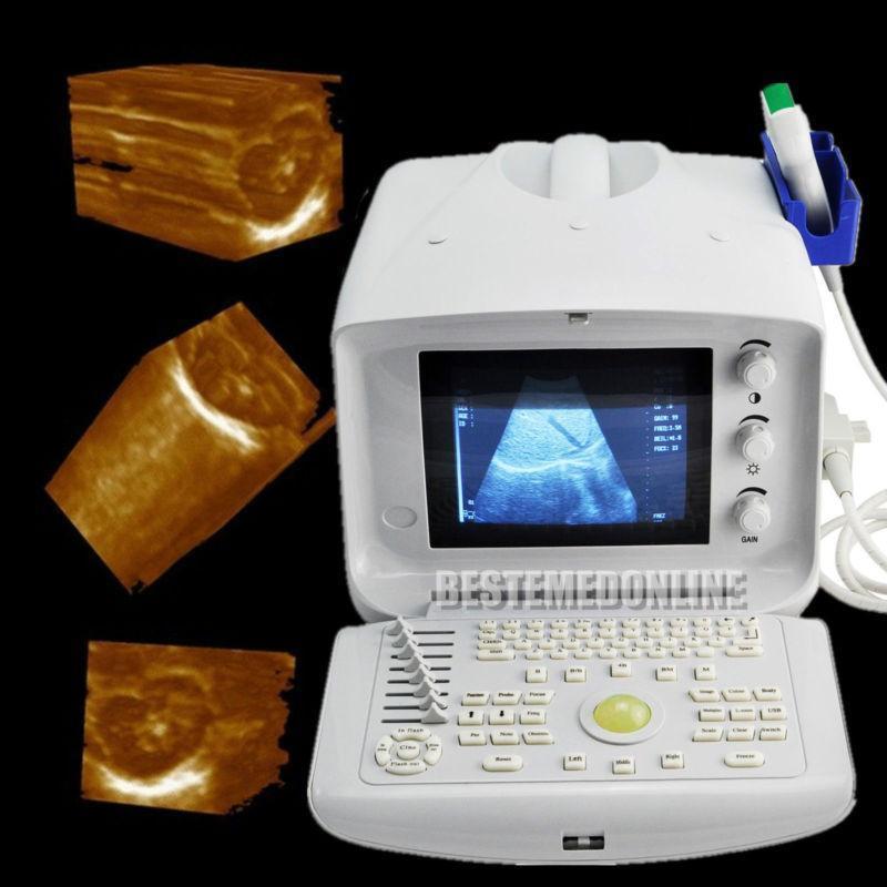 Portable Ultrasound ultrasonic Scanner Machine convex +Transvaginal Probes JXKH! DIAGNOSTIC ULTRASOUND MACHINES FOR SALE