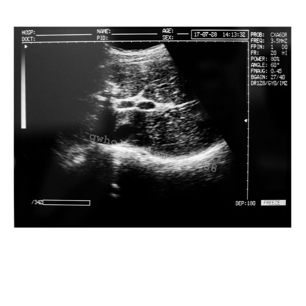 Laptop Ultrasound Machine Scanner Convex Probe 3D Software Clear Medical Clinic 190891045898 DIAGNOSTIC ULTRASOUND MACHINES FOR SALE