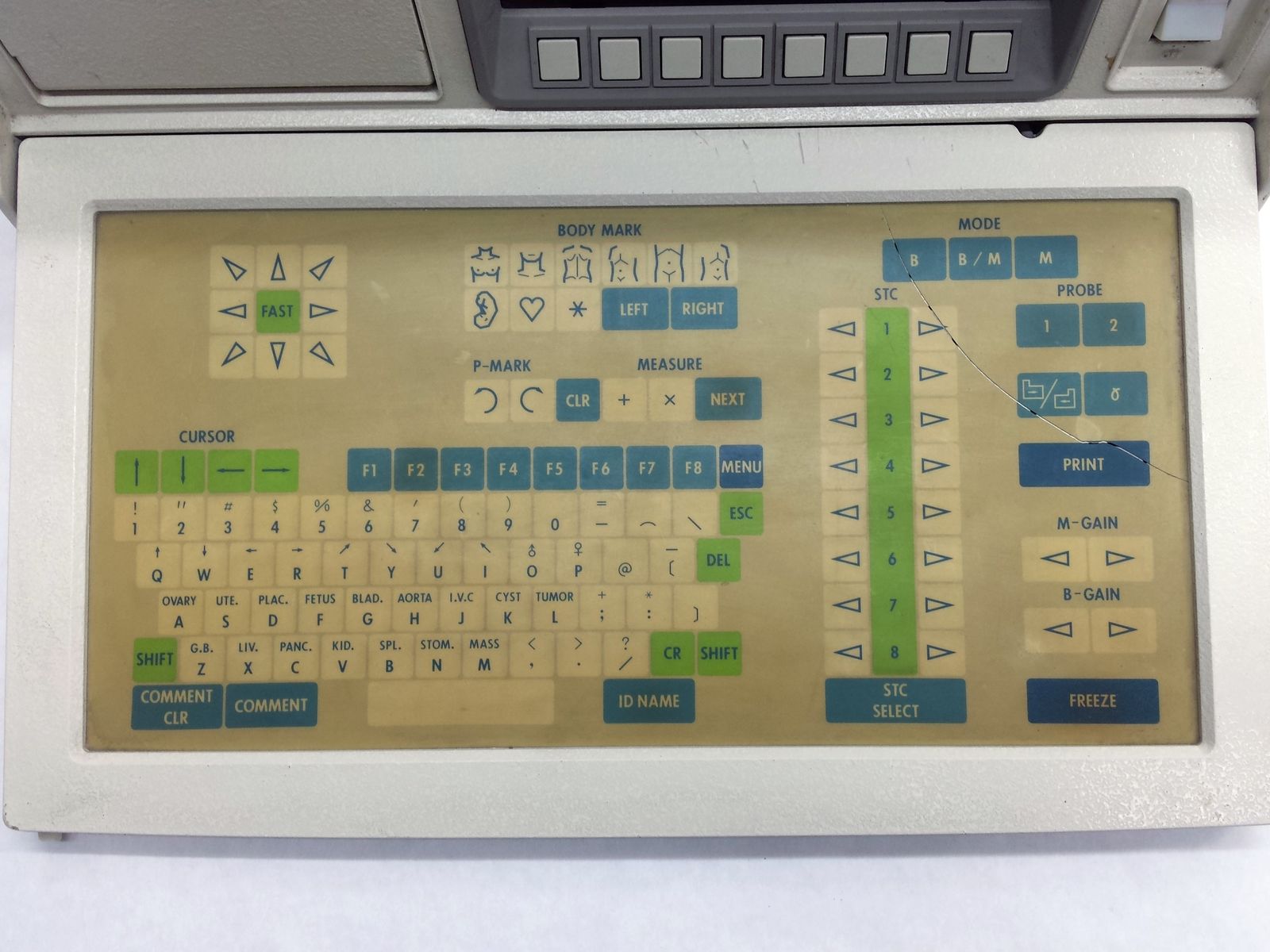 SHIMADZU SHIMASONIC SDL-310 OB/GYN ULTRASOUND DIAGNOSTIC IMAGING PATIENT MONTIOR DIAGNOSTIC ULTRASOUND MACHINES FOR SALE