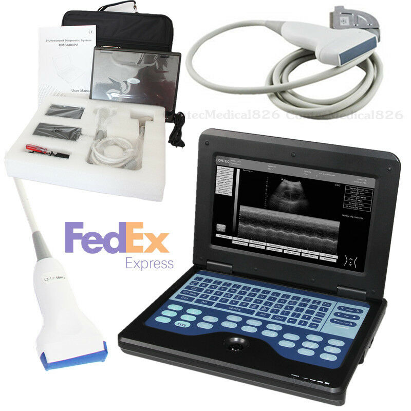 Portable Laptop Machine,Notebook Ultrasound Scanner,7.5Mhz Linear Probe,US Fedex 6945040100362 DIAGNOSTIC ULTRASOUND MACHINES FOR SALE