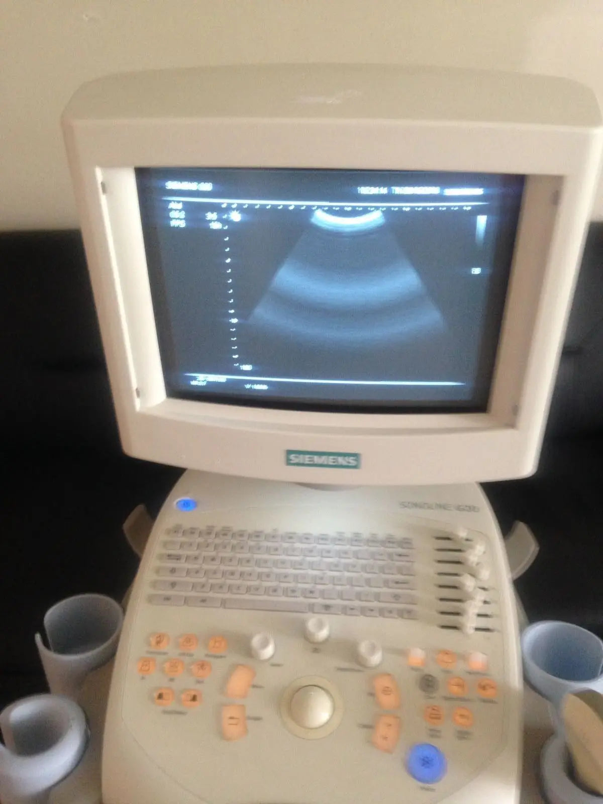 Siemens Sonoline G20 Diagnostic Ultrasound System DIAGNOSTIC ULTRASOUND MACHINES FOR SALE