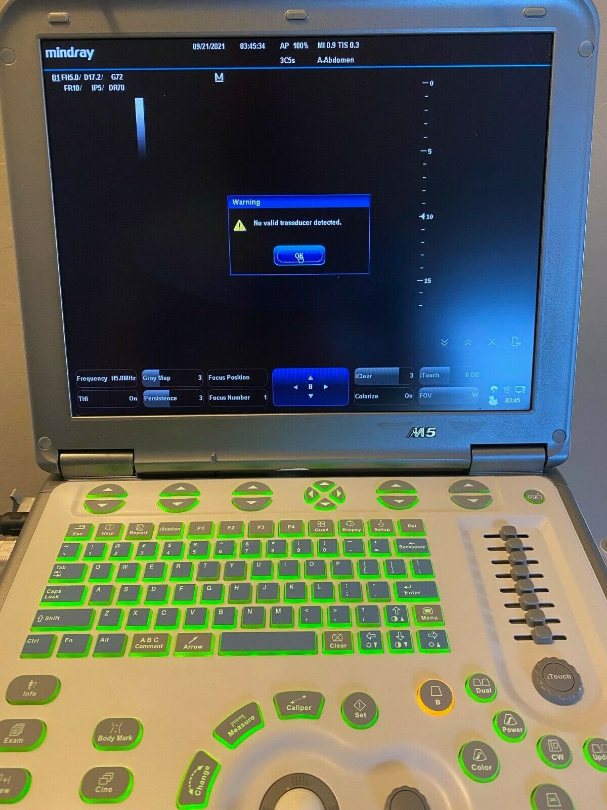 Mindray M5 Ultrasound- Refurbished with 2 Probes and Cart DIAGNOSTIC ULTRASOUND MACHINES FOR SALE