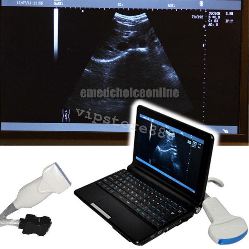 Full Digital Laptop Ultrasound Scanner Linear 9000F + Free 3D Linear probe New DIAGNOSTIC ULTRASOUND MACHINES FOR SALE