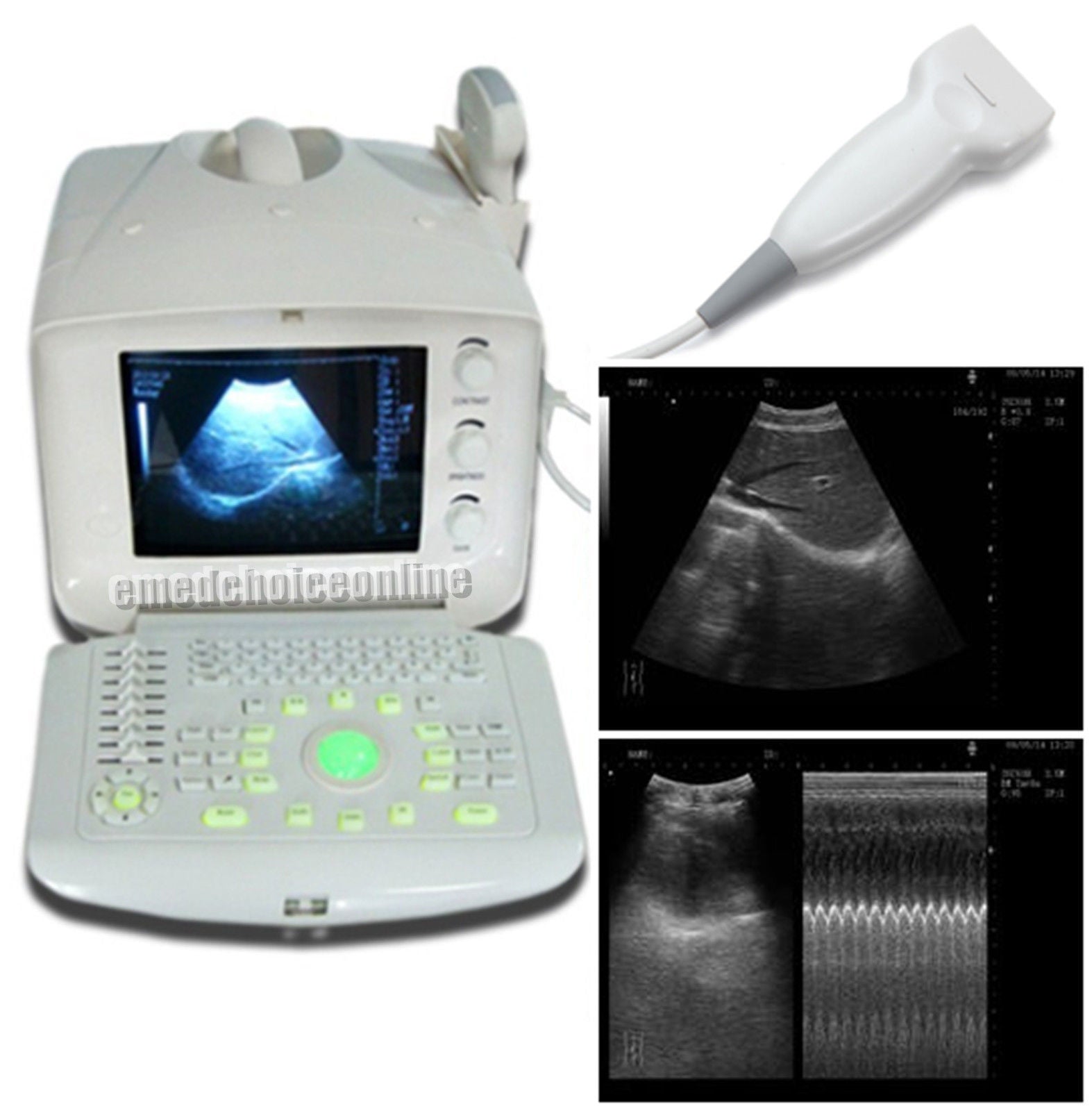 Digital Portable Ultrasound Scanner/Machine/System +7.5Mhz Linear probe +Free 3D DIAGNOSTIC ULTRASOUND MACHINES FOR SALE