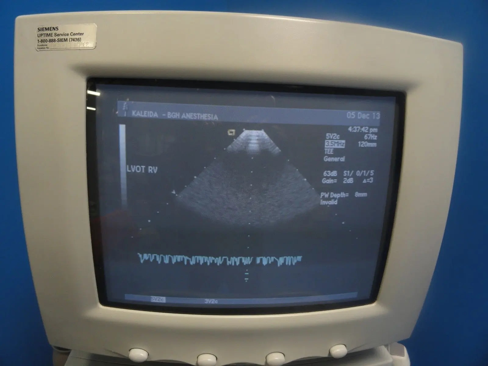 2002 Acuson Sequoia C256 Cardiac Ultrasound W/ 5V2C Probe Printer & VCR (6066) DIAGNOSTIC ULTRASOUND MACHINES FOR SALE