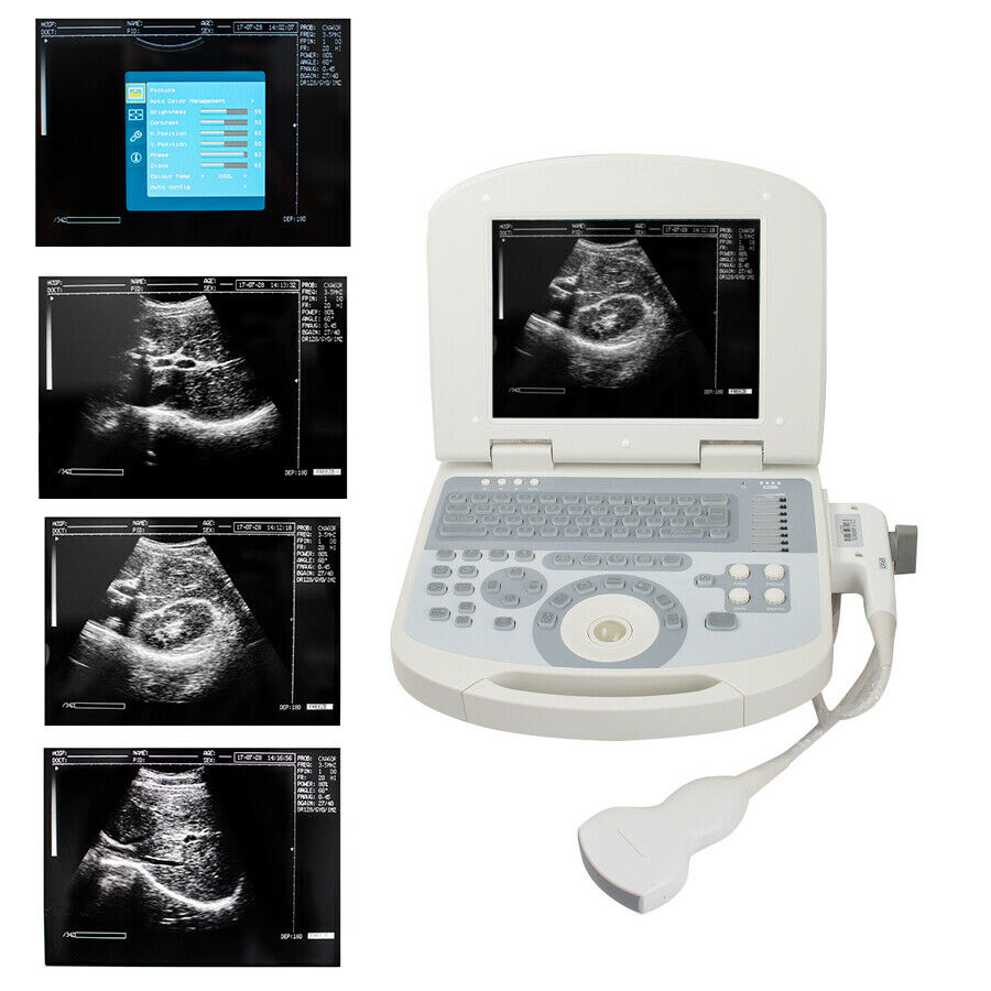 Digital Medical Ultrasound Scanner +3.5MHZ Convex Probe with 3D Software DIAGNOSTIC ULTRASOUND MACHINES FOR SALE