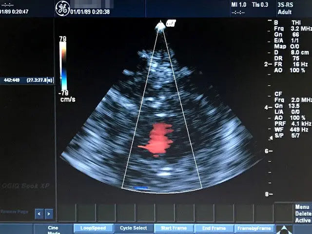 GE LOGIQ BOOK XP ULTRASOUND WITH 3-PROBE DIAGNOSTIC ULTRASOUND MACHINES FOR SALE