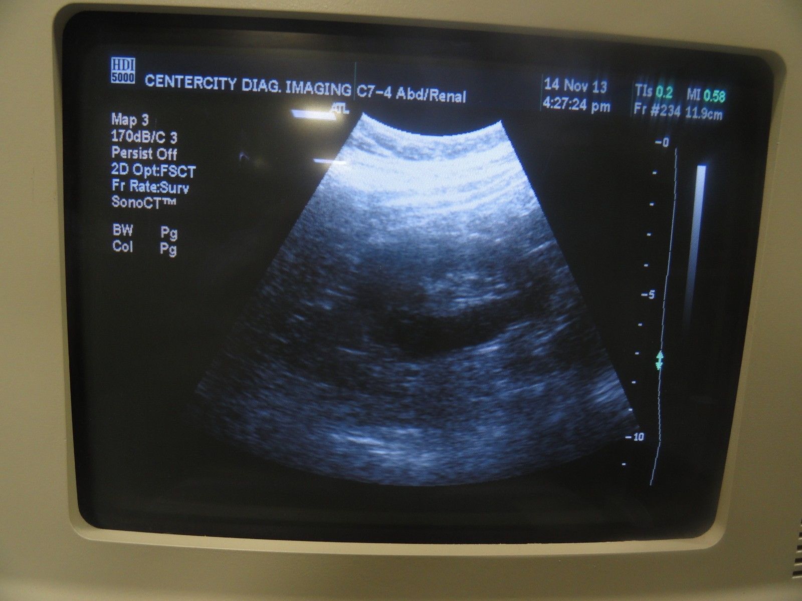 2009 Philips C7-4 40R Curved Array Convex Probe for ATL HDI Series (5963 ) DIAGNOSTIC ULTRASOUND MACHINES FOR SALE