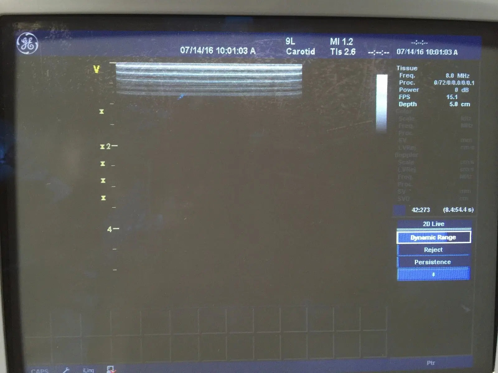 GE 9L Ultrasound Transducer for GE Logiq 9 Systems DIAGNOSTIC ULTRASOUND MACHINES FOR SALE